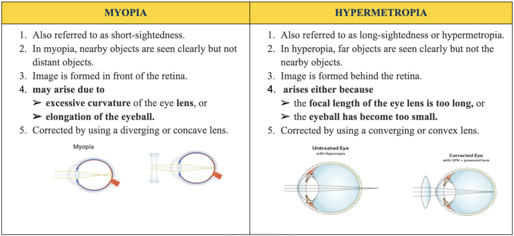 myopia-hypermetropia
