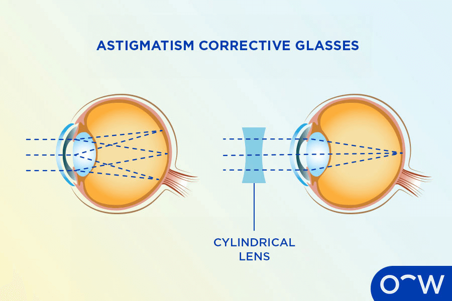 Human Eye and Defects