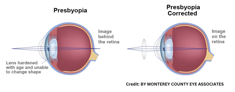 Human Eye and Defects